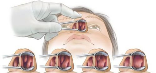 Những thông tin chi tiết về bệnh lý sẽ giúp bác sĩ chẩn đoán chính xác tình trạng bệnh